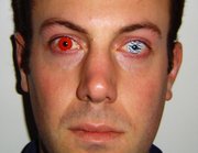A person seen wearing two different styles of cosmetic contact lenses