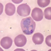 Red blood cell infected with P.vivax