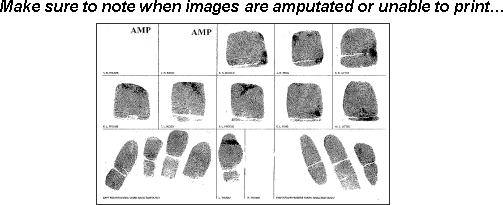 Fingerprint card showing notation of amputated fingers