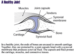 An illustration of a Healthy Joint
