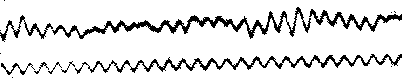 The first EEG recording, obtained by  in 1929.