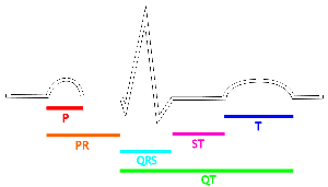 Drawing of the EKG, with labels of intervalsP=P wave, PR=PR segment, QRS=QRS complex, QT=QT interval, ST=ST segment, T=T wave.