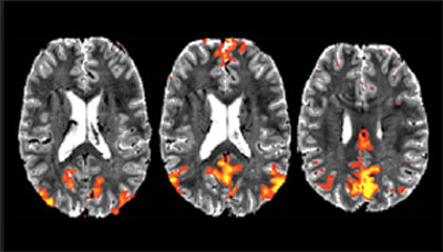 mri of brain from the Human Connectome Project